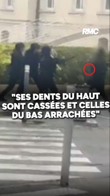 "Ses dents du bas ont été complètement arrachées": les parents d'Eden, 14 ans, blessé par une grenade lors d'une mobilisation lycéenne à Saint-Ouen-L'Aumône témoignent