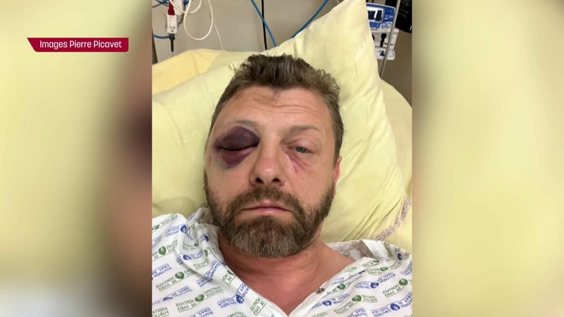 Agression homophobe d’un policier à Paris: le suspect mis en examen pour violences aggravées mais laissé libre sous contrôle judiciaire