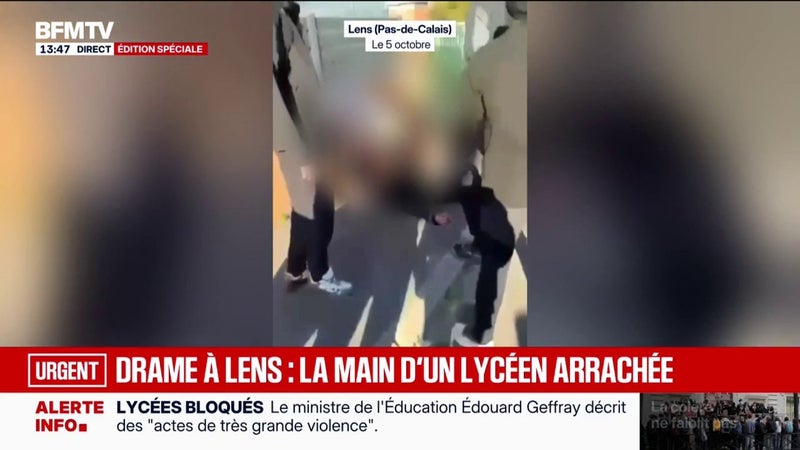IMAGES SENSIBLES - Un lycéen de 15 ans a eu la main "arrachée" à Lens, l'IGPN saisie
