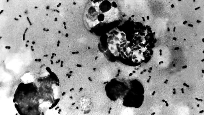 Faut-il s'inquiéter d'un retour de la peste après la mort mystérieuse d'une scientifique dans un laboratoire en Russie?