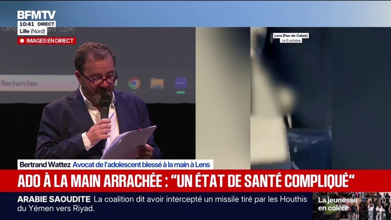 "Nous avons été choqués": l'avocat du lycéen amputé à Lens conteste la version des faits du parquet