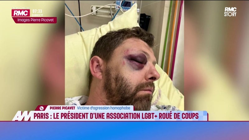Paris : un président d'une association LGBT+ roué de coups