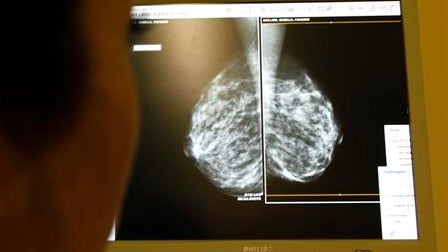"Les hommes sont de plus en plus ouverts à la parole": en Essonne, un premier "Café Prostate" pour échanger autour du cancer