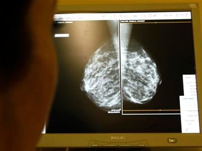 "Les hommes sont de plus en plus ouverts à la parole": en Essonne, un premier "Café Prostate" pour échanger autour du cancer