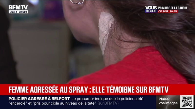 "Il ne faut pas qu'ils s'en sortent comme ça": la femme agressée au spray enflammé à Marseille témoigne