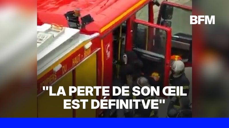 Manifestations du 17 octobre: une adolescente de 17 ans a perdu l’usage de son œil, l’IGPN saisie