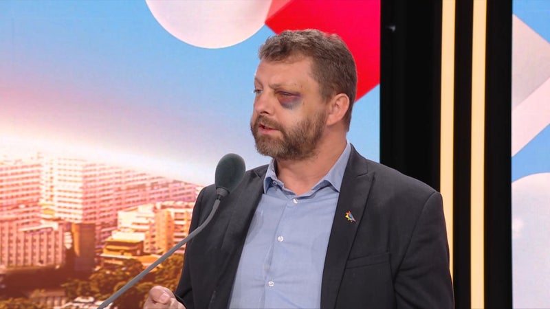 "Il m'a mis un coup de bouteille, m'a jeté au sol...": ce policier raconte en détail la violente agression homophobe qu'il a subie