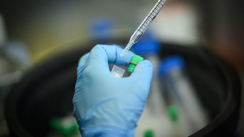On connaissait les vaccins contre la grippe ou le Covid: comment le cancer est devenu le nouveau pari des géants de la pharma (mais à quel prix?)