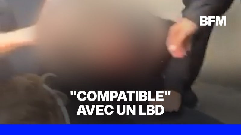 Lycéen blessé à Tours: les lésions "compatibles" avec un tir de LBD, assure la procureure