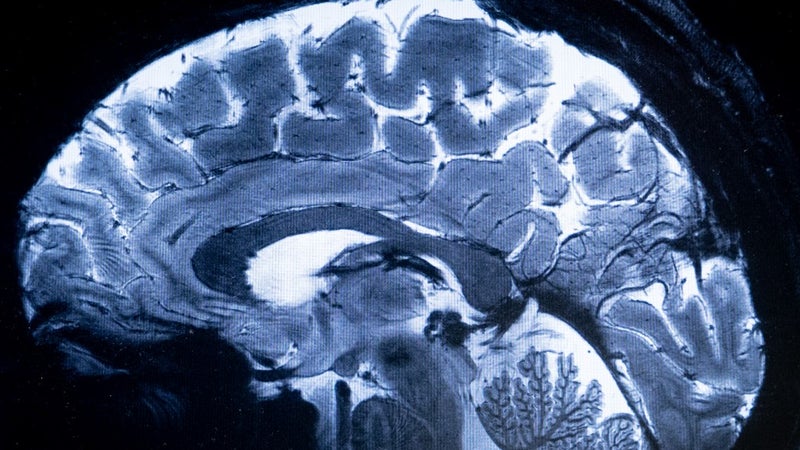 Le cerveau humain est composé de deux organes distincts, selon une étude menée par l'université de Stanford