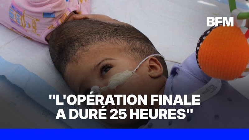 États-Unis: des médecins séparent avec succès des jumelles soudées par la tête